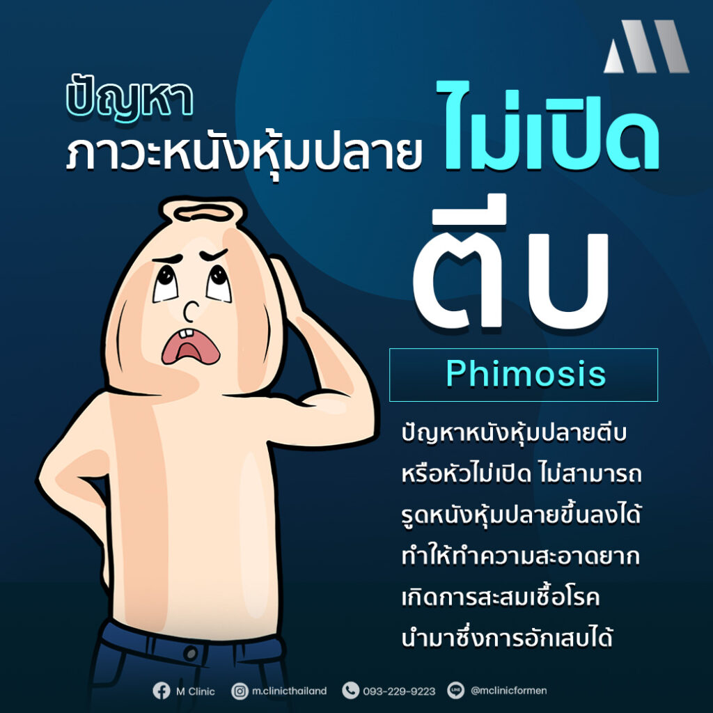 #สุขภาพผู้ชาย #วัยทอง #ED #ฮอร์โมน #อาหารเสริม #สุขภาพ #Men #สูงวัย #ขริบ #ขลิบ