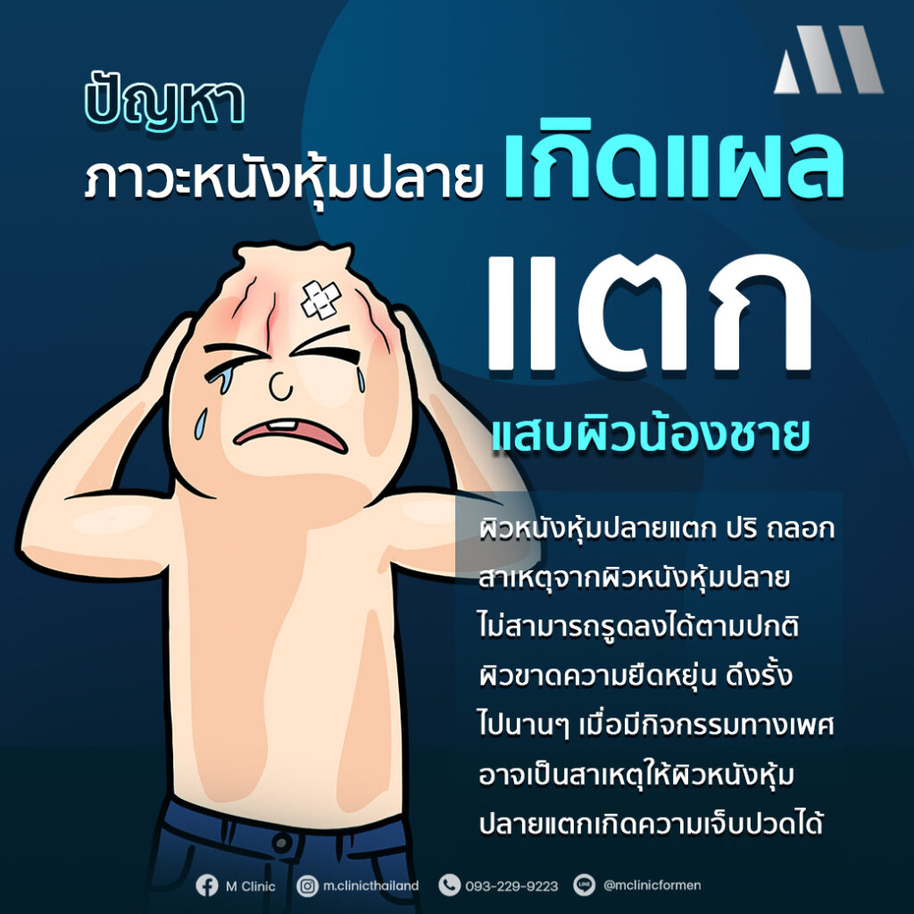 #สุขภาพผู้ชาย #วัยทอง #ED #ฮอร์โมน #อาหารเสริม #สุขภาพ #Men #สูงวัย #ขริบ #ขลิบ