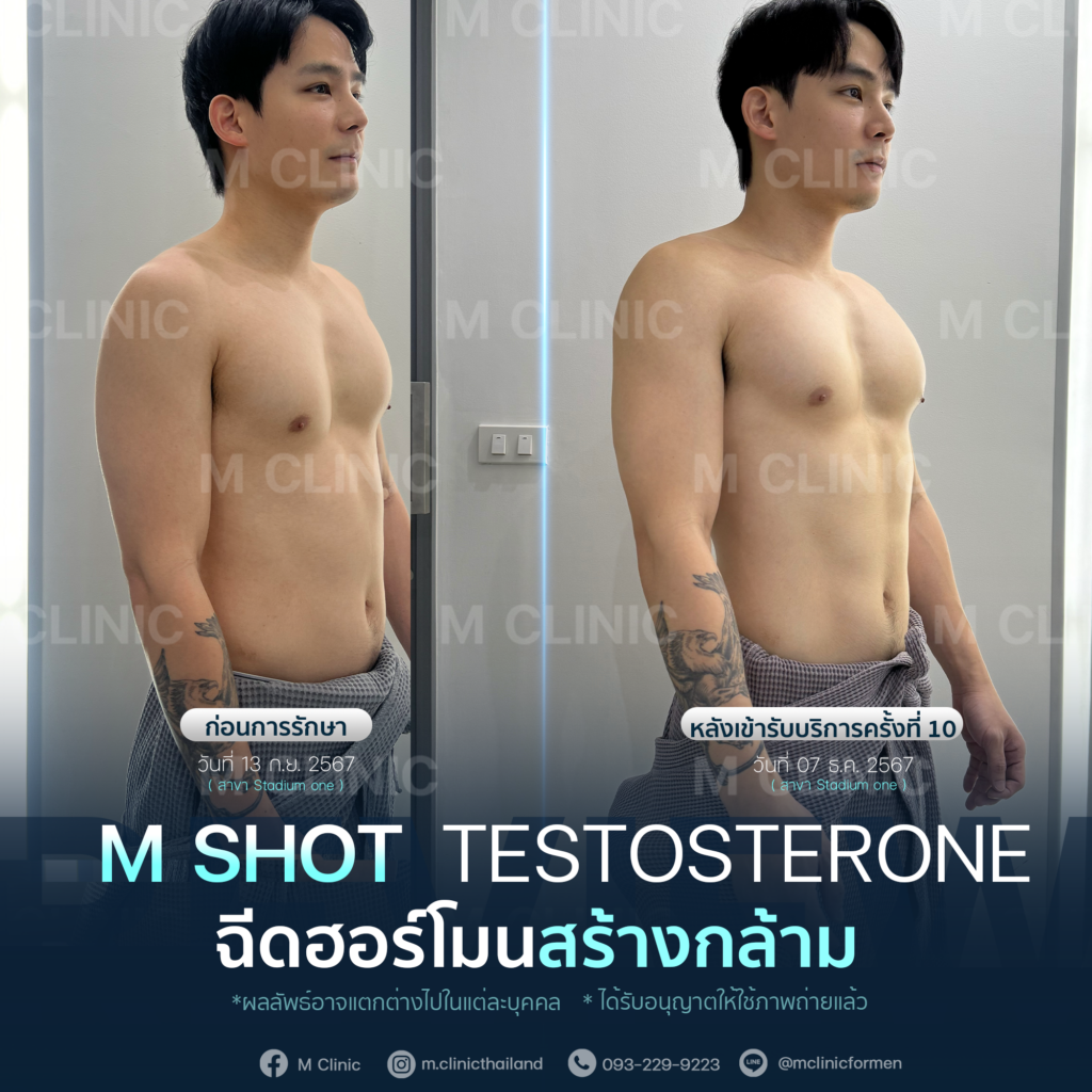 #Testosterone #เพิ่มมวลกล้าม #เพิ่มกล้าม #กล้าม #muscle