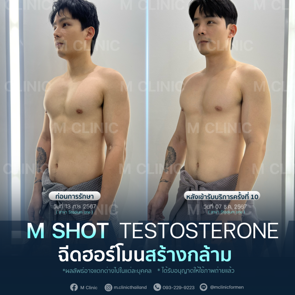 #Testosterone #เพิ่มมวลกล้าม #เพิ่มกล้าม #กล้าม #muscle