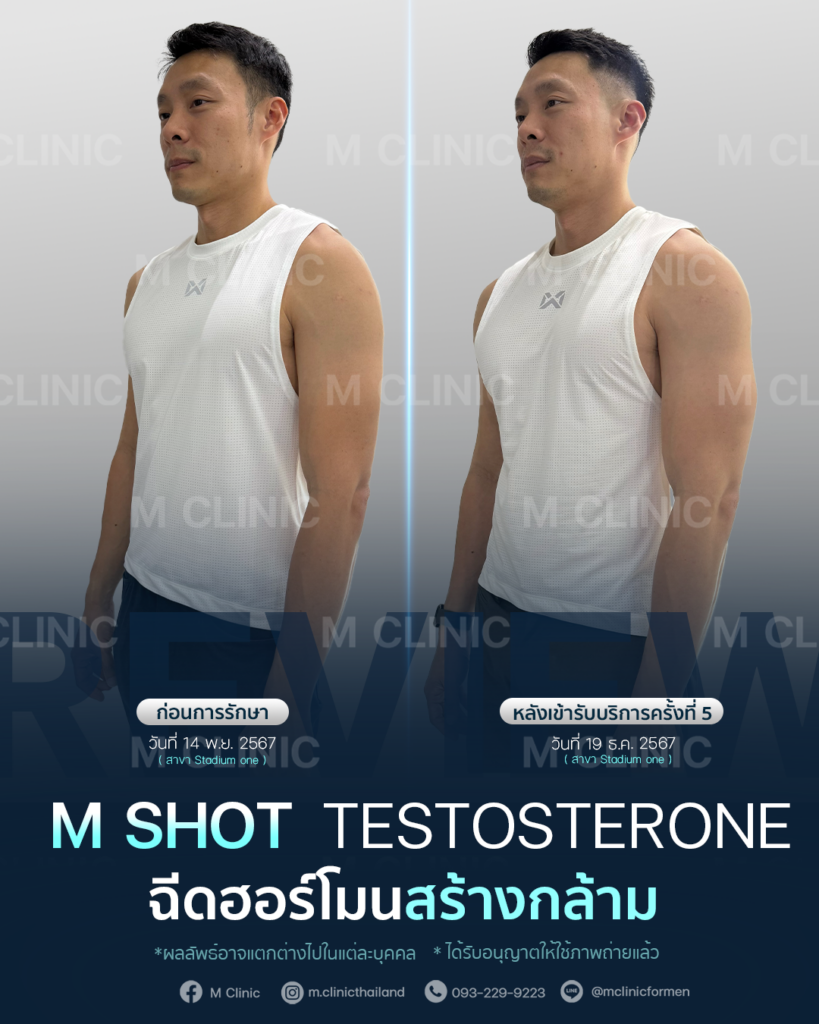 #Testosterone #เพิ่มมวลกล้าม #เพิ่มกล้าม #กล้าม #muscle