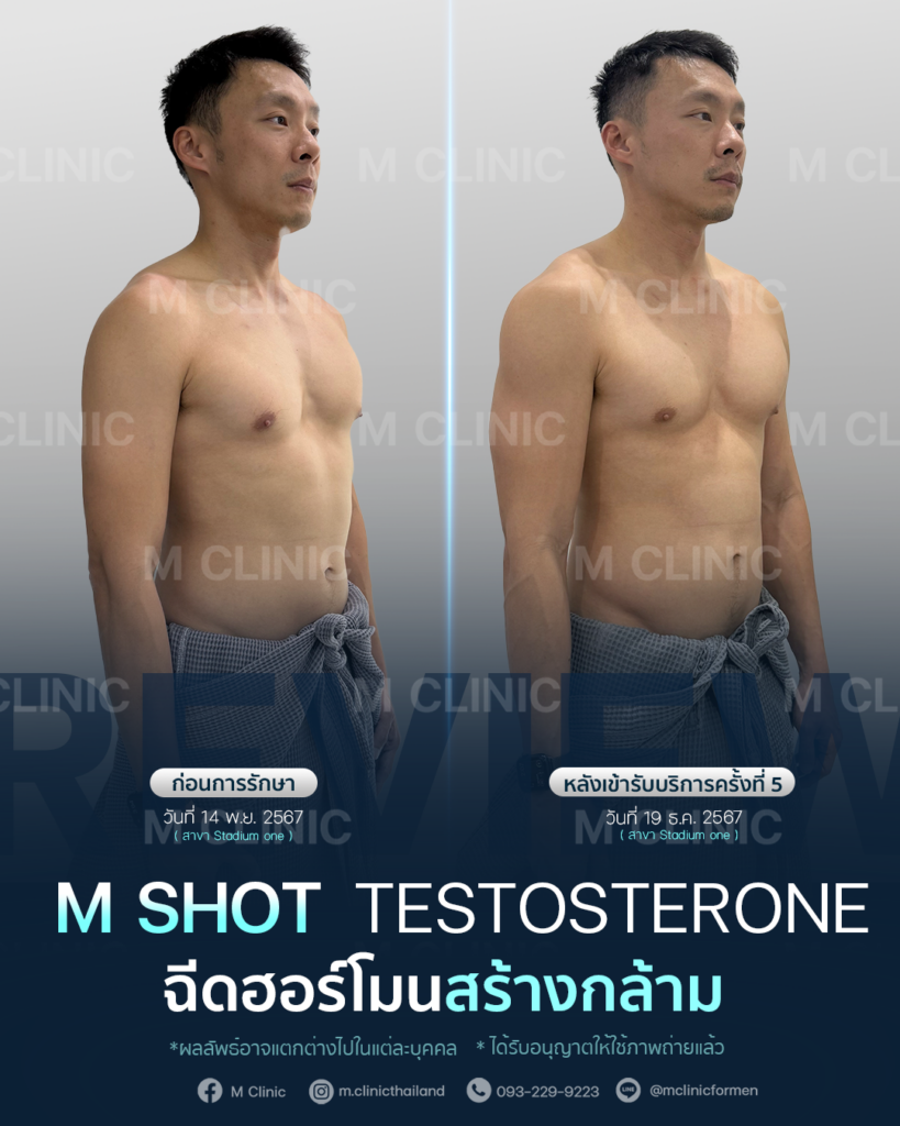 #Testosterone #เพิ่มมวลกล้าม #เพิ่มกล้าม #กล้าม #muscle