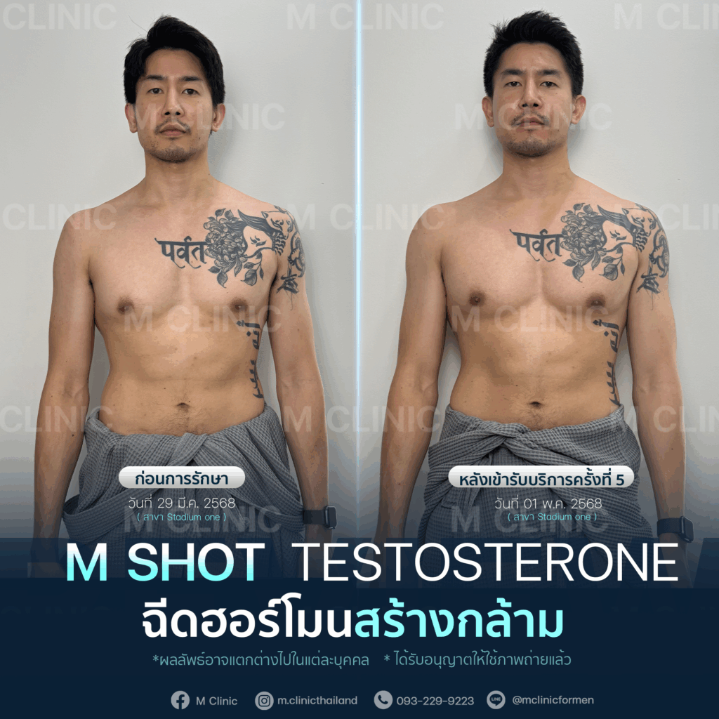 #Testosterone #เพิ่มมวลกล้าม #เพิ่มกล้าม #กล้าม #muscle