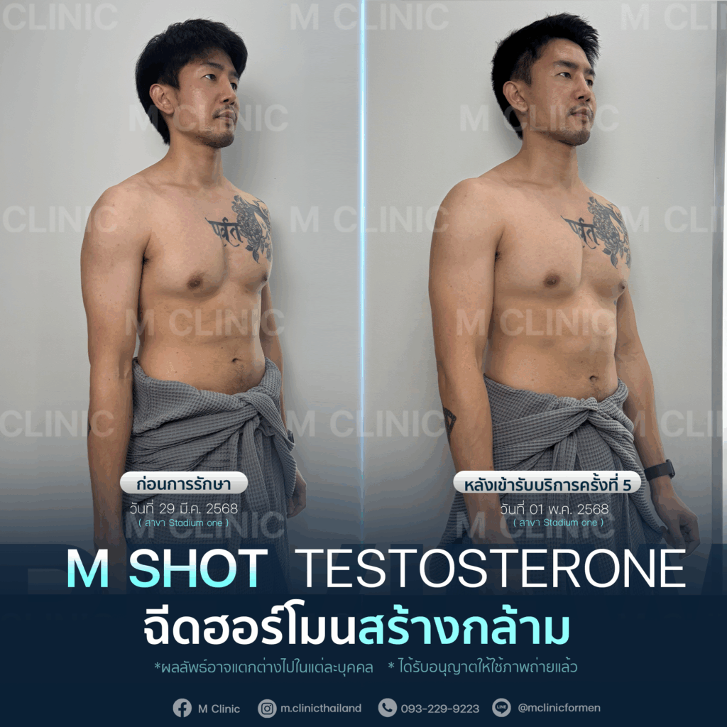 #Testosterone #เพิ่มมวลกล้าม #เพิ่มกล้าม #กล้าม #muscle