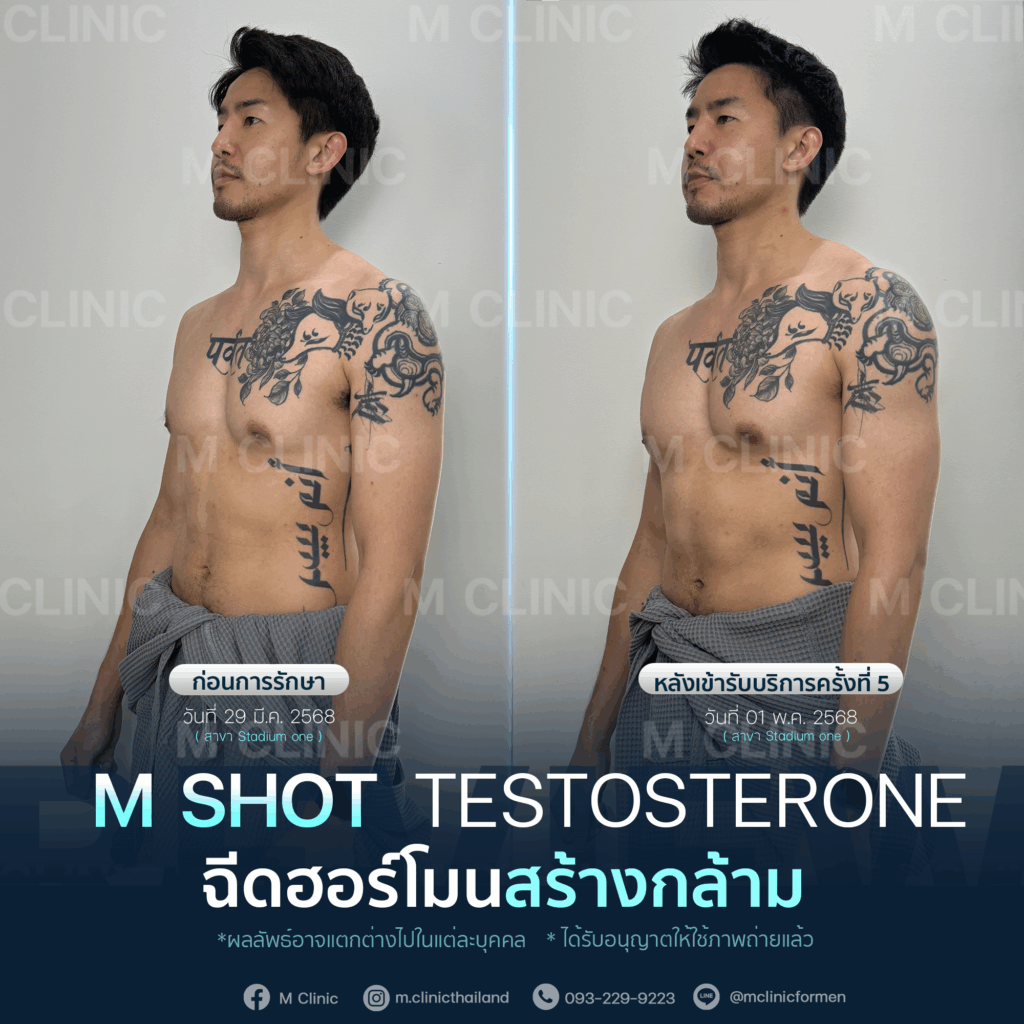 #Testosterone #เพิ่มมวลกล้าม #เพิ่มกล้าม #กล้าม #muscle