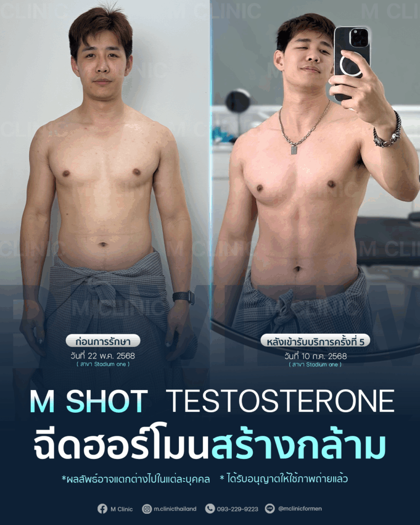 #Testosterone #เพิ่มมวลกล้าม #เพิ่มกล้าม #กล้าม #muscle