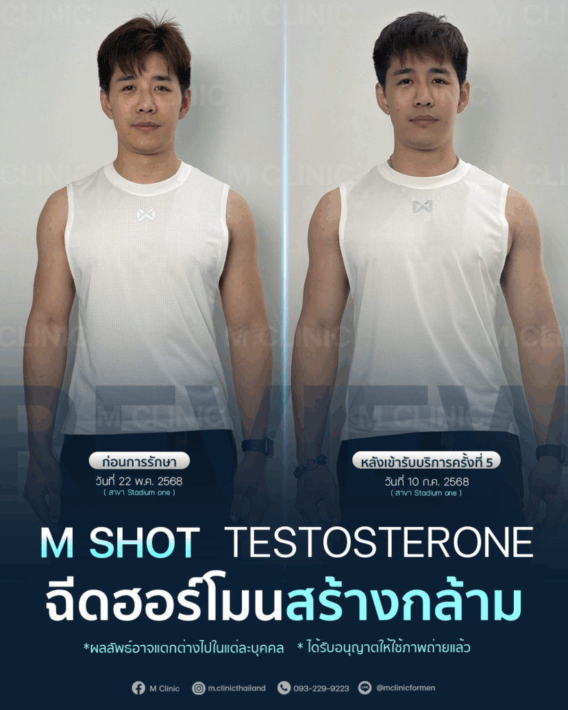 #Testosterone #เพิ่มมวลกล้าม #เพิ่มกล้าม #กล้าม #muscle