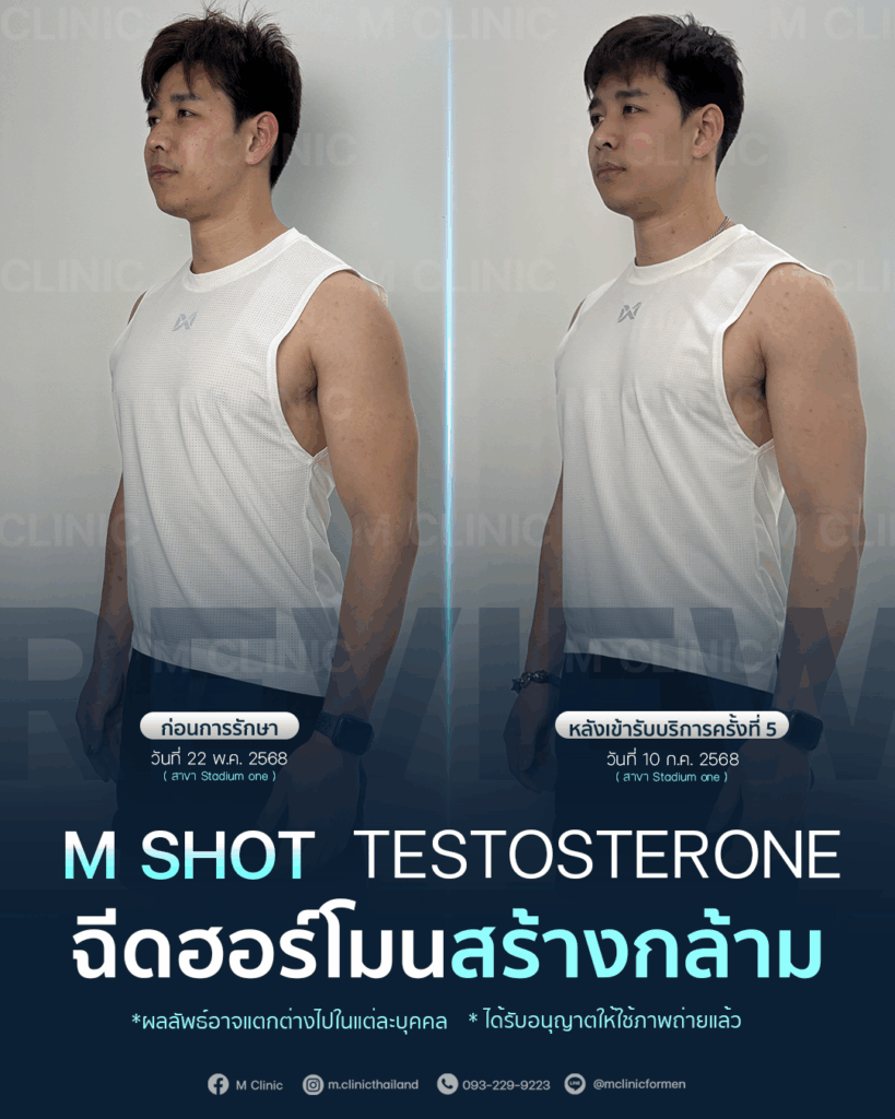 #Testosterone #เพิ่มมวลกล้าม #เพิ่มกล้าม #กล้าม #muscle
