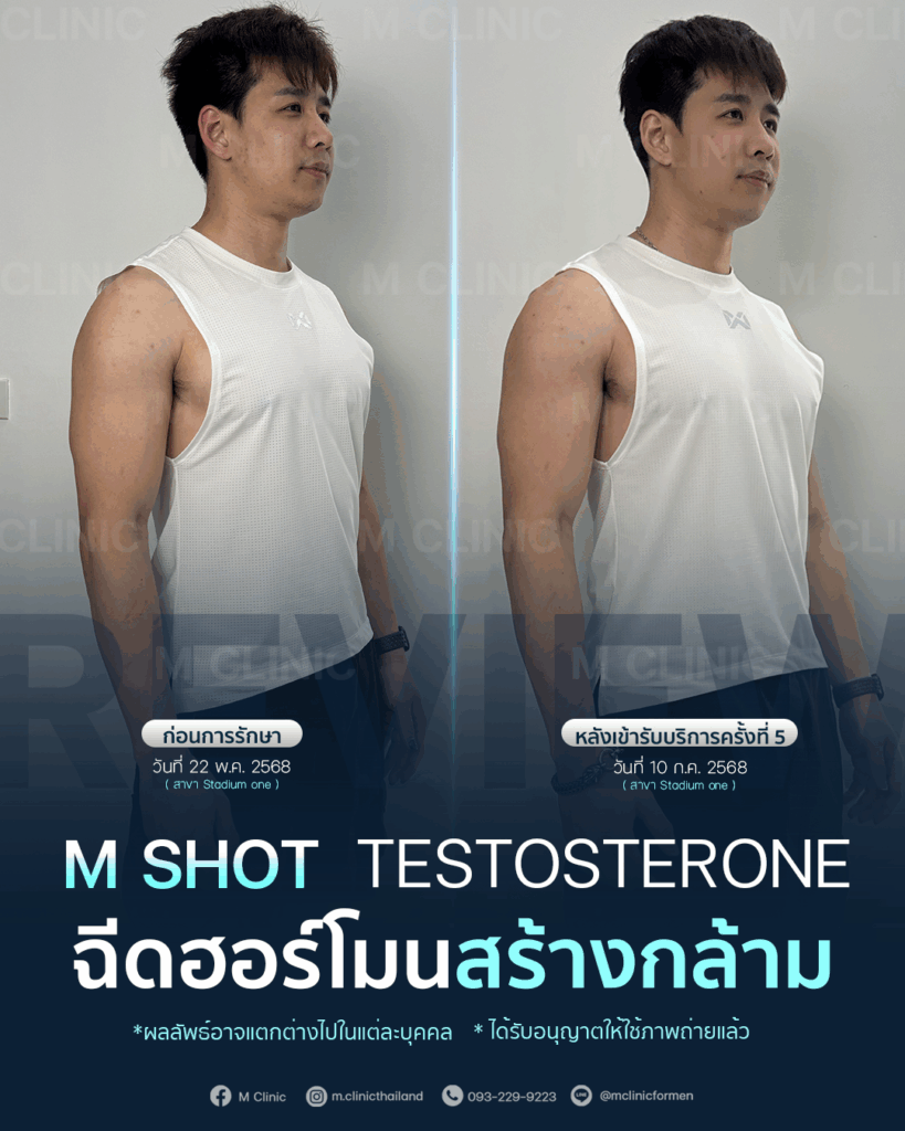 #Testosterone #เพิ่มมวลกล้าม #เพิ่มกล้าม #กล้าม #muscle