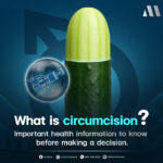 #ขริบ #CIRCUMCISION #clinicformen #รีวิวMClinic