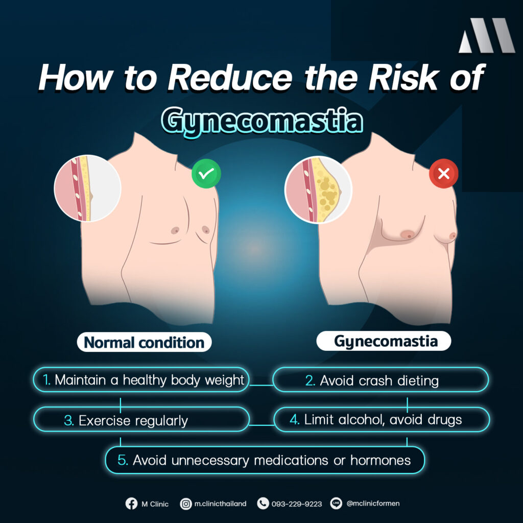 #Gynecomastia #ภาวะนมแหลมในผู้ชาย #นมแหลม