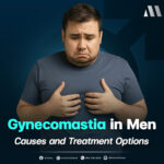 #Gynecomastia #ภาวะนมแหลมในผู้ชาย #นมแหลม
