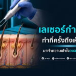 เลเซอร์ขน ทำกี่ครั้งถึงเห็นผล? มาทำความเข้าใจวงจรขนก่อนทำ