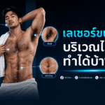 เลเซอร์ขนผู้ชาย บริเวณไหนทำได้บ้าง?